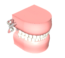 wind up teeth