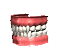 dentures