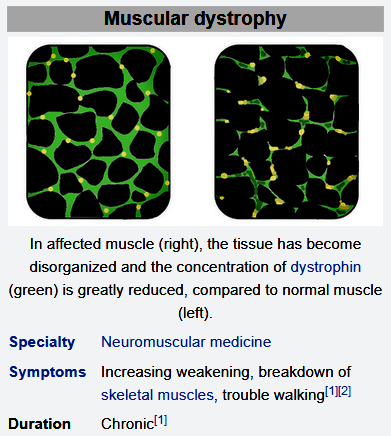 the wikipedia entry for Muscular Dystrophy