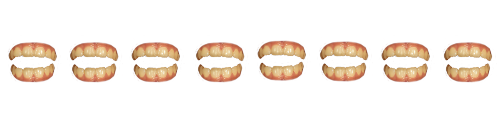 missing image