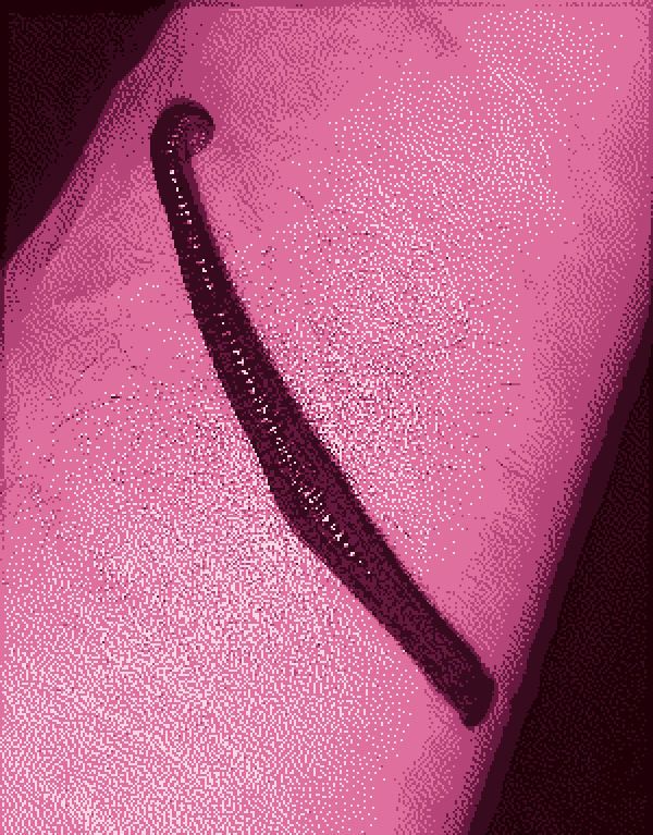 leech feeding on a forearm