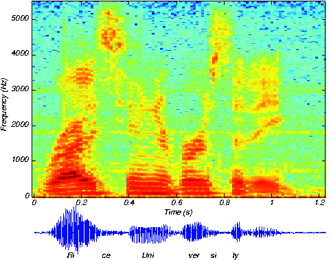 Spectrogram