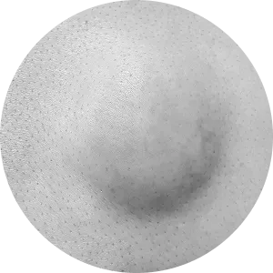 지방종