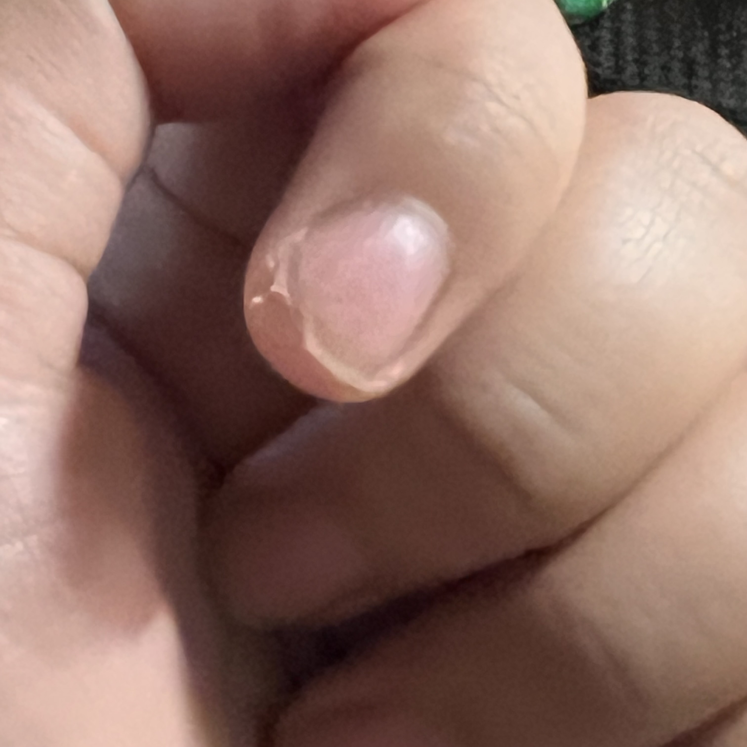 my nail...